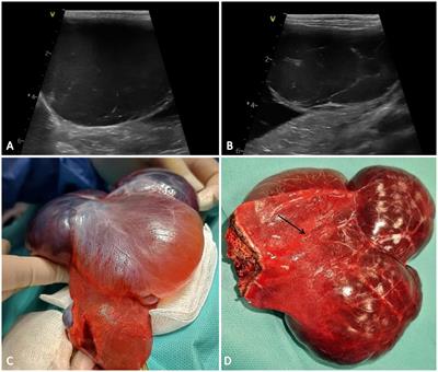 Hepatic vascular hamartoma in a cat: a case report with literature review